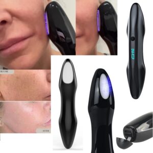 Newest Portable Plasma Beauty Machine Acne Treatment Ozone Plasma Pen